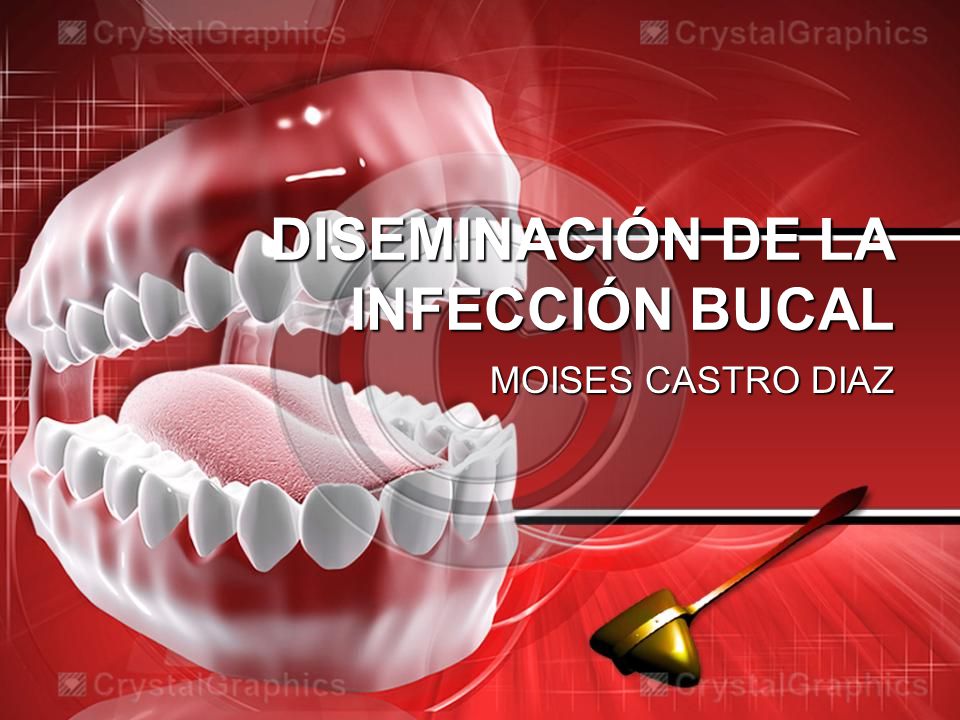 vias de propagacion de infecciones odontogenicas